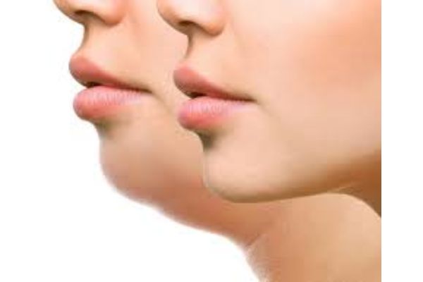 face yoga for jawline by shwet yoga classes in thane west