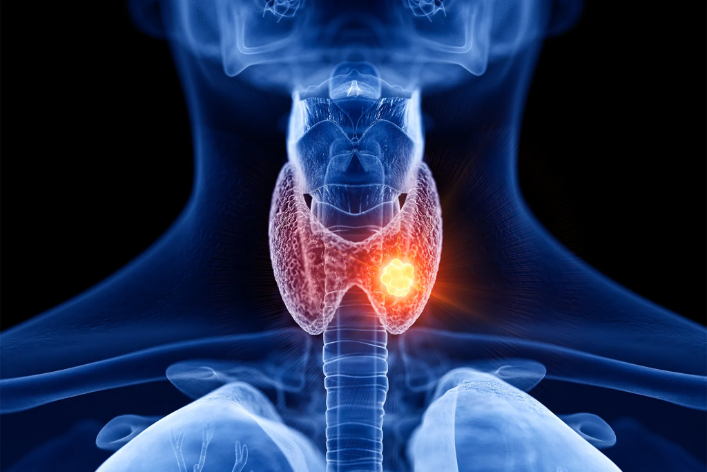 yoga for thyroid by shwet yoga classes in thane west