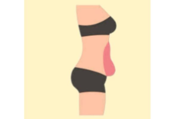 belly fat reduction at weight loss program at shwet yoga classes in thane west